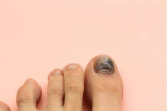 3. Purple and Black Toe Nail Art Inspiration - wide 2