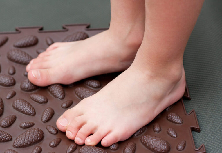 Child's feet that have juvenile bunions just starting to develop