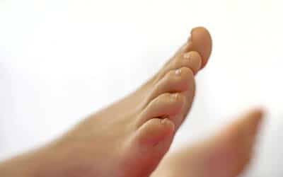 When Should You See a Doctor About Your Ingrown Toenails?