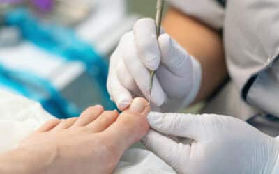 Ingrown Toenail Treatment & Prevention: Complete Guide for Fast Relief